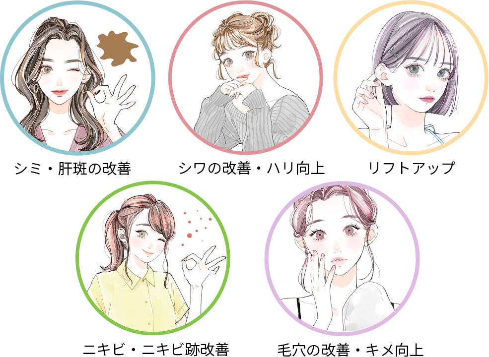 エレクトロポレーションのメリット