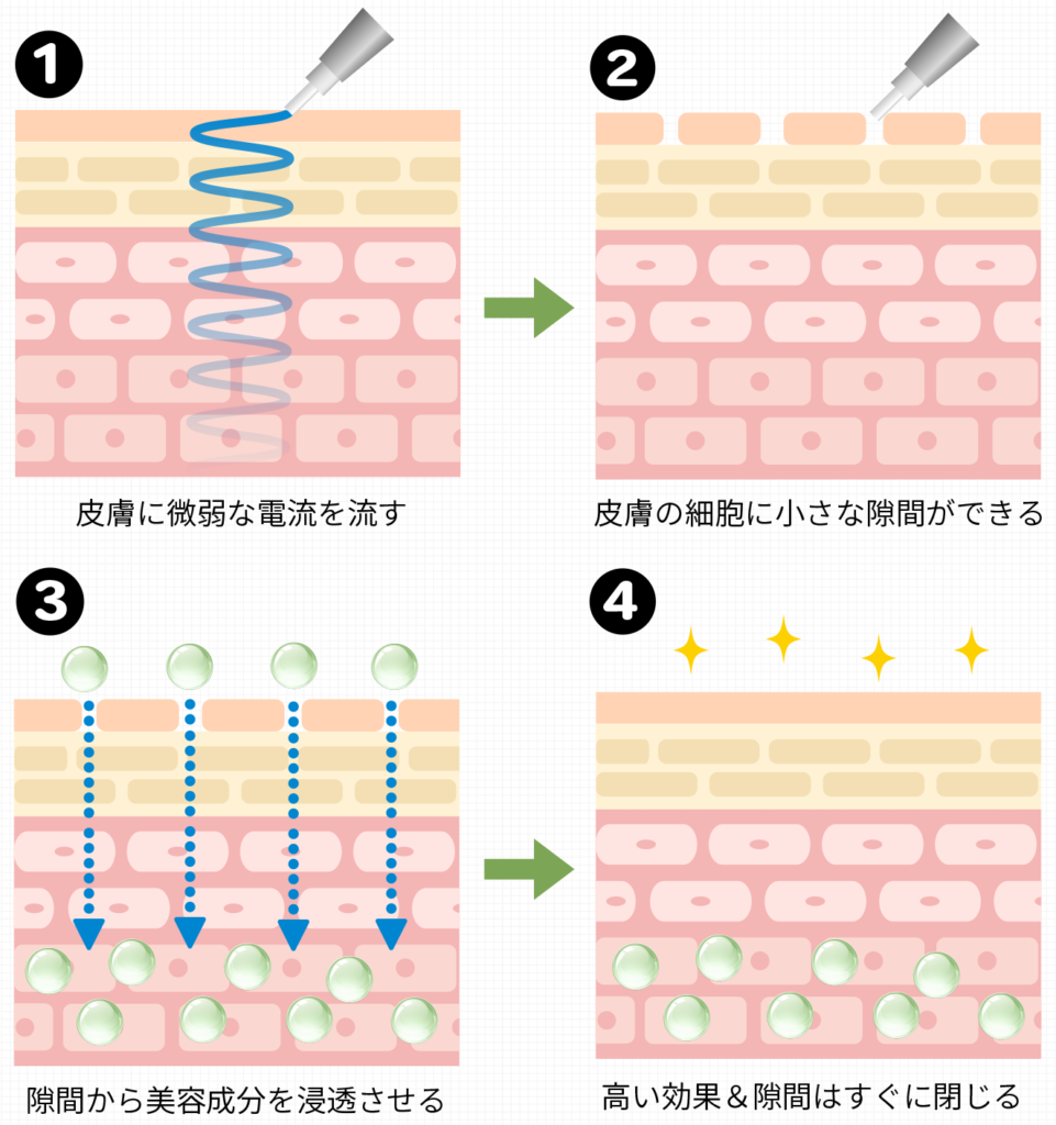 エレクトロポレーションの仕組み