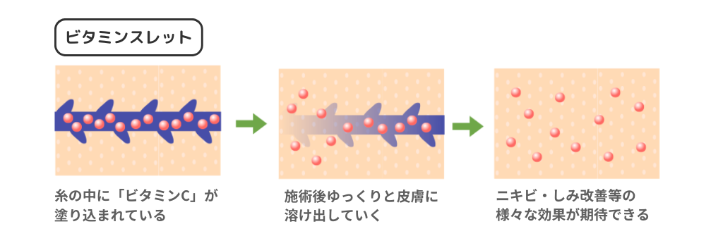 ビタミンスレット