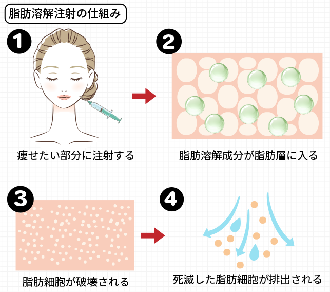 脂肪溶解注射の仕組み